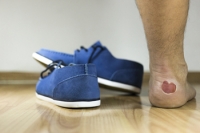 Wearing Tight Shoes May Cause Blisters