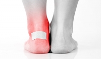 What Is a Blister and Why Do They Form?
