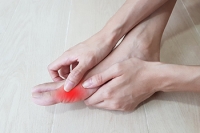 Comparing Bunion and Gout Symptoms