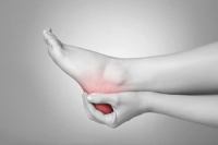 Why Does Plantar Fasciitis Occur?